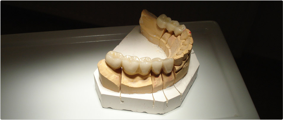 Müller Dental - Dental Hungary, Dentist Hvz, Hungarian Dental